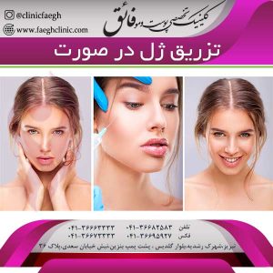 تزریق ژل در صورت