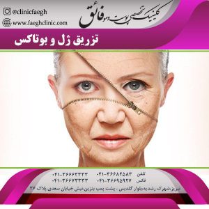 بوتاکس