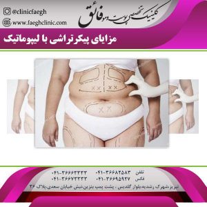 مزایای پیکرتراشی با لیپوماتیک