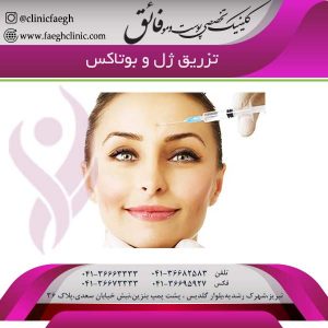 تزریق ژل و بوتاکس
