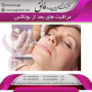 مراقبت های بعد از بوتاکس