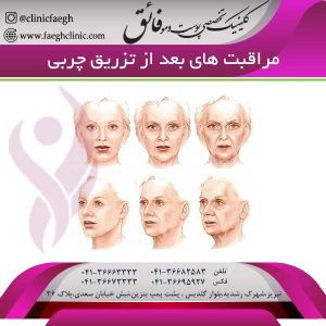 مراقبت های بعد از تزریق چربی