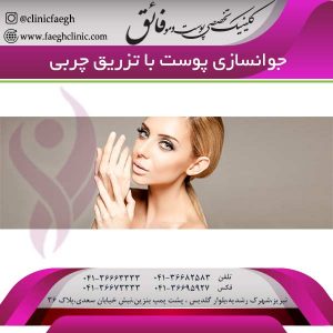 جوانسازی پوست با تزریق چربی